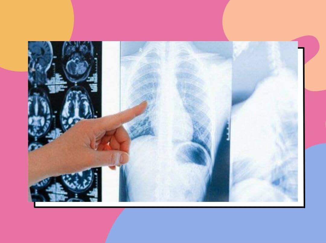 ফুসফুসে কি বড় কোনও অসুখ বাসা বাঁধছে? এই লক্ষণগুলি  বুঝুন
