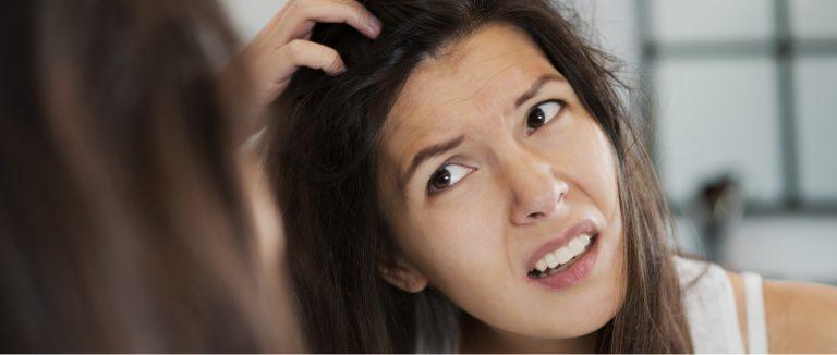 Home Remedies For Dandruff