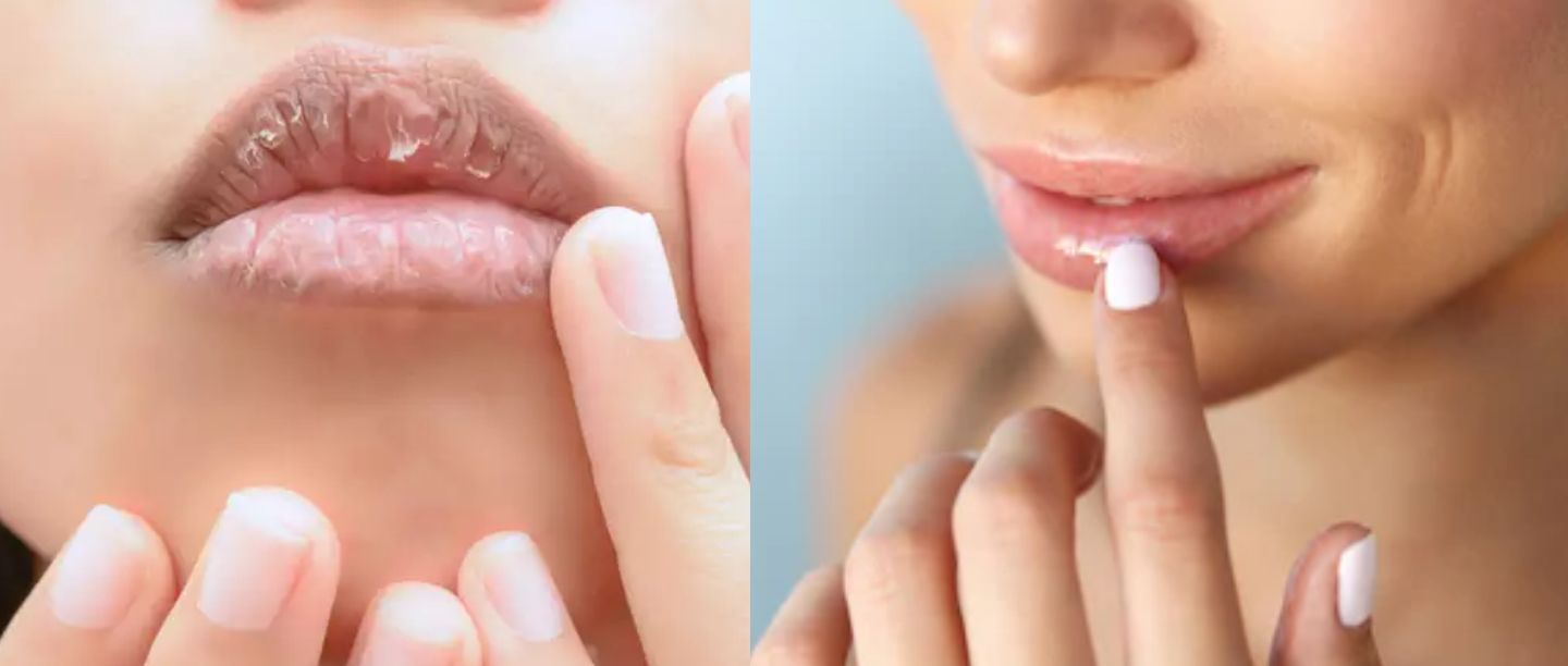 Winter Lips Care Tips in Hindi, lip care tips, dry lips