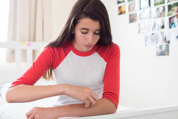 Psoriasis Treatment in Hindi