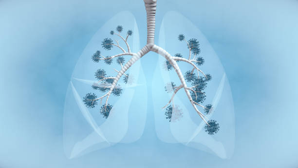 Lungs Infection in Hindi