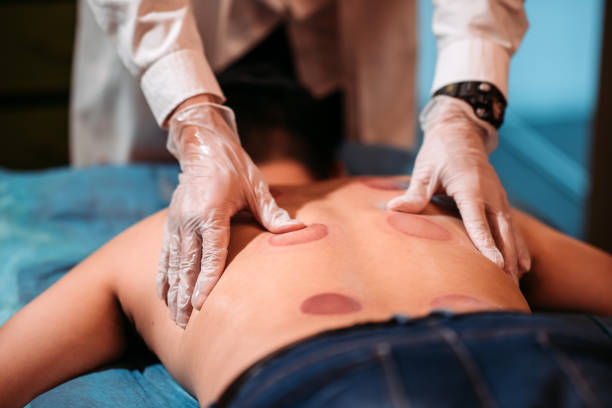 Cupping Therapy kaise ki Jati Hai