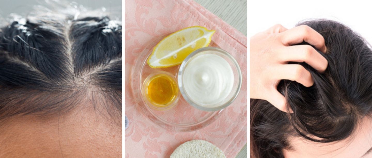 How To Fix Greasy Hair  SUGAR Cosmetics