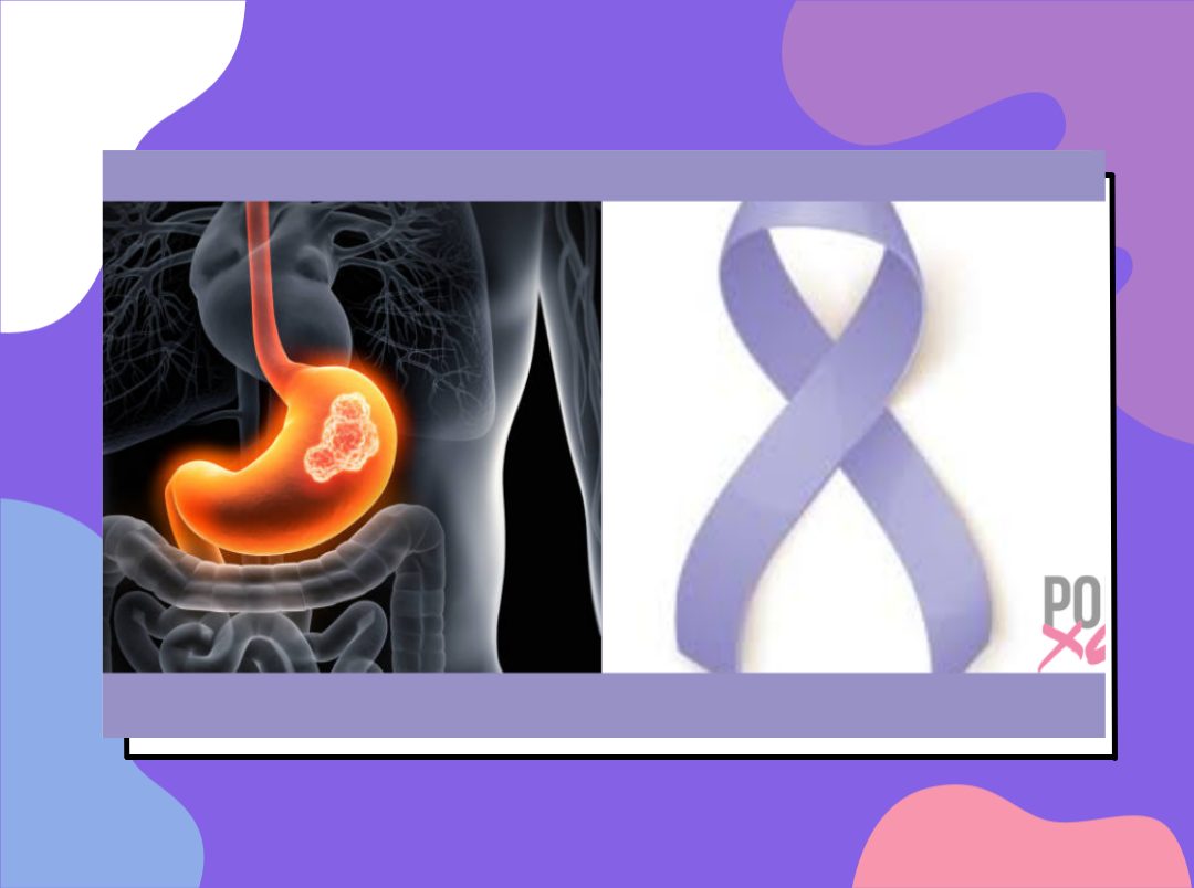 Stomach Cancer Information in Marathi