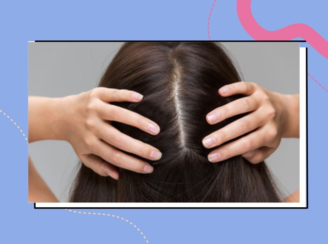 how-should-women-take-care-of-scalp-in-marathi