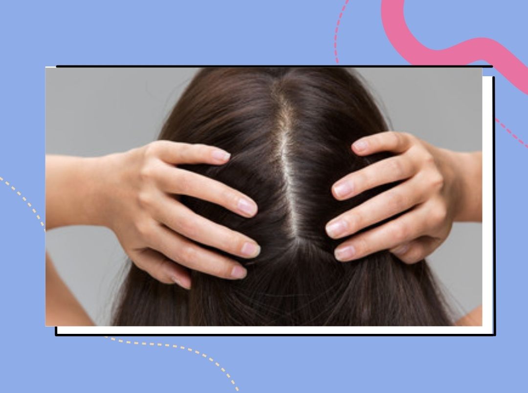 how should women take care of scalp in marathi