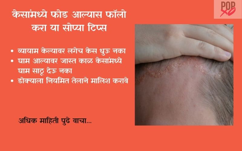 केसांमध्ये फोड आल्यास फॉलो करा या सोप्या टिप्स