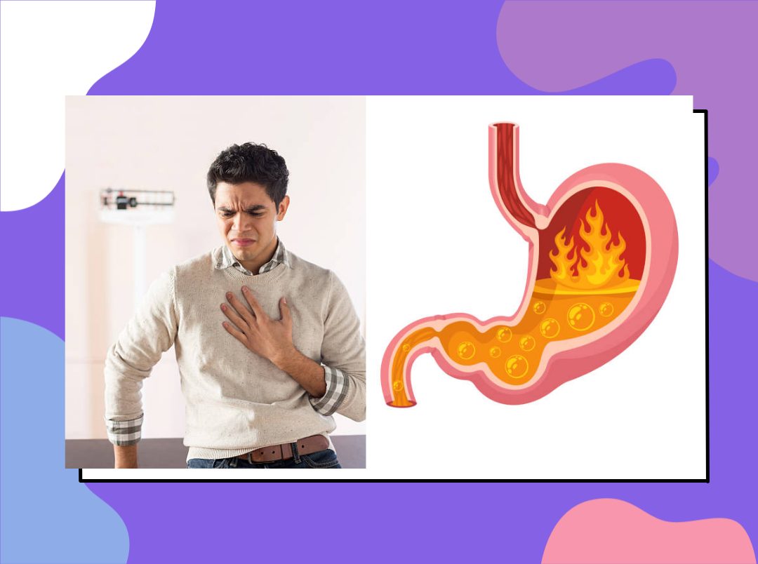 heartburn vs acid reflux