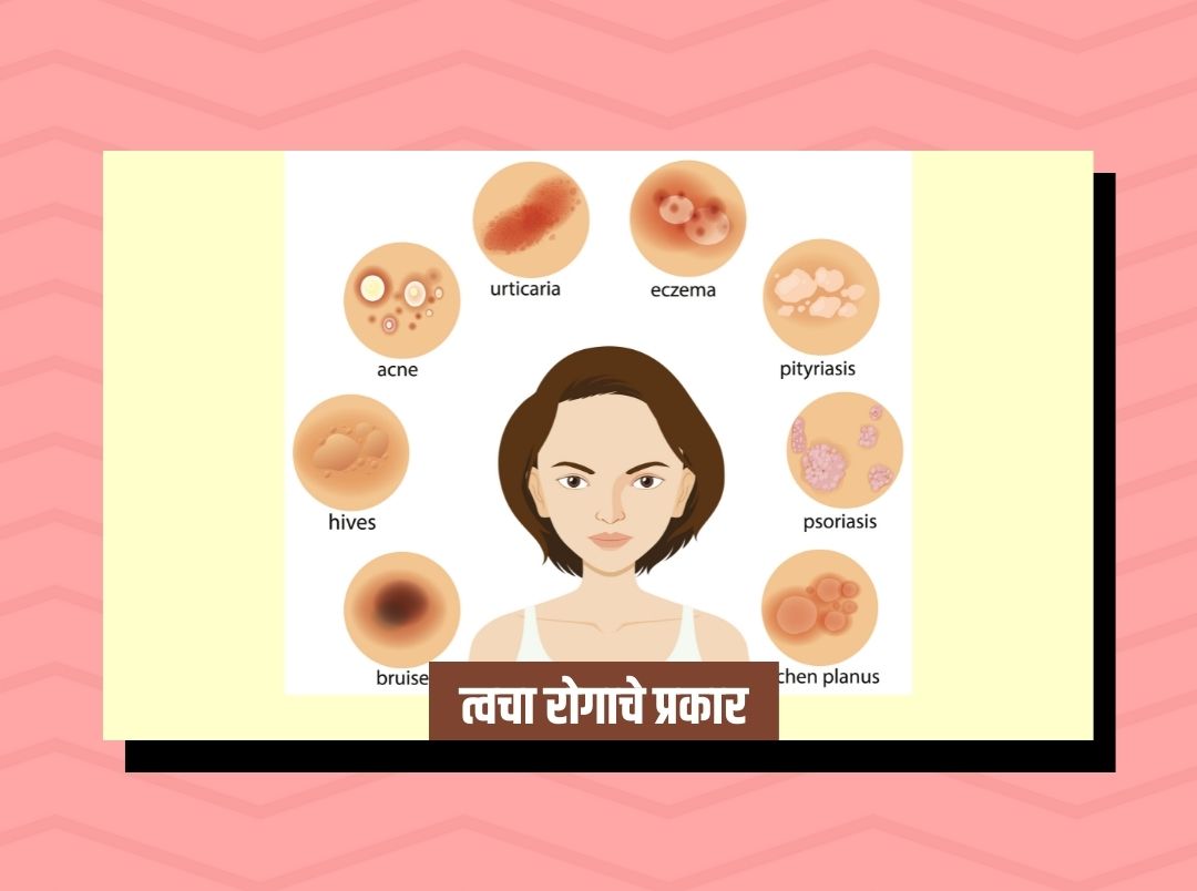 15-types-of-skin-disease-in-marathi