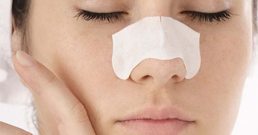 blackheads001 முகத்தில் தோன்றும் கரும்புள்ளிகளை முற்றிலுமாக நீக்க வேண்டுமா?