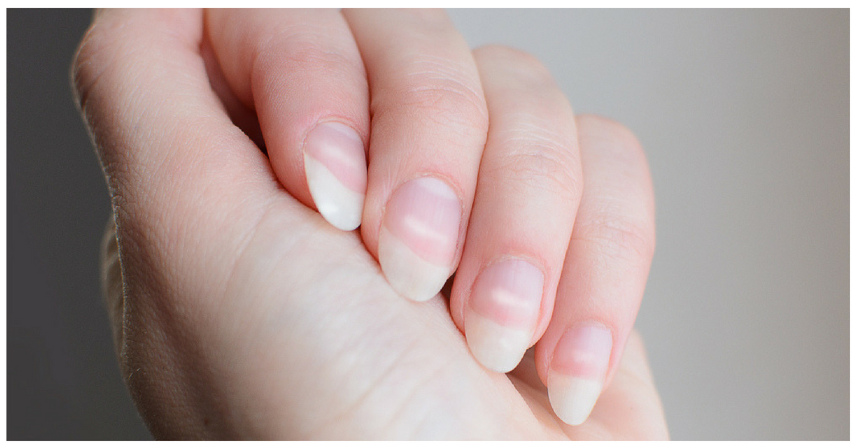 Here's What Is Really Causing Those White Spots On Your Nails | POPxo