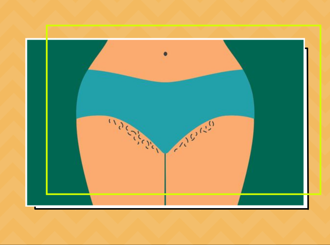 Shaving, Waxing Or Hair Removal Creams? Everything You Need To Know About Pubic Hair Removal