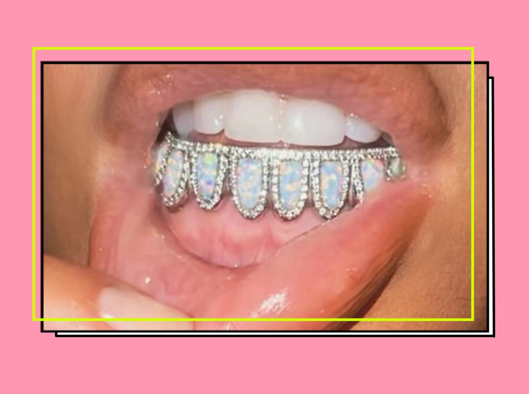 Tooth Jewels: Decoding What A Dentist Really Thinks About The Tooth Sparkles Trend