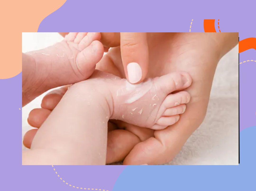 7-home-remedies-for-your-baby-s-dry-skin-i-popxo