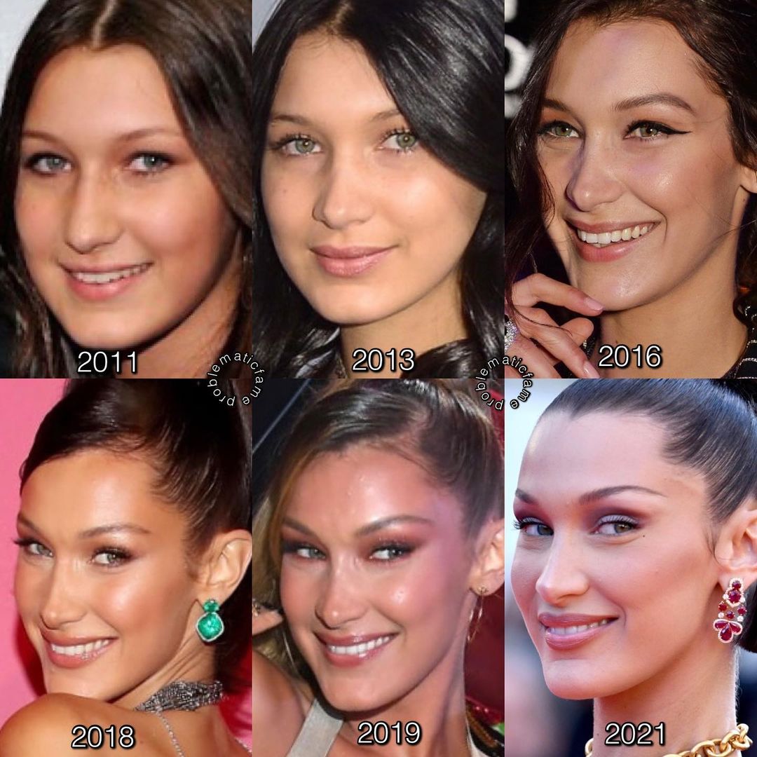 Heres Why Bella Hadid Regrets Getting A Nose Job Popxo