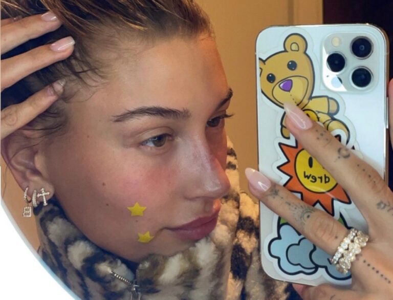 Adult Acne Is More Common Than You’d Think &amp; Even Hailey Struggles With It!